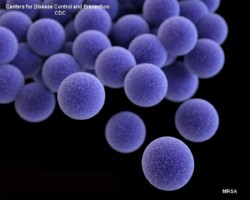 Image of MRSA, MRSA 3d model